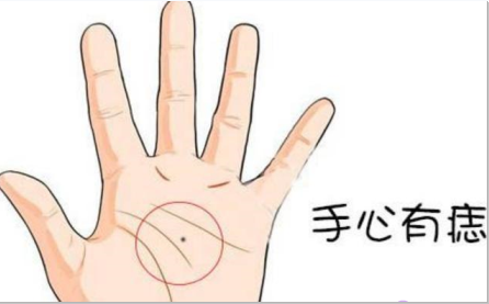 掌心痣是福是禍，看完這三點(diǎn)，再決定要不要點(diǎn)痣