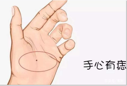 掌心痣是福是禍，看完這三點(diǎn)，再決定要不要點(diǎn)痣