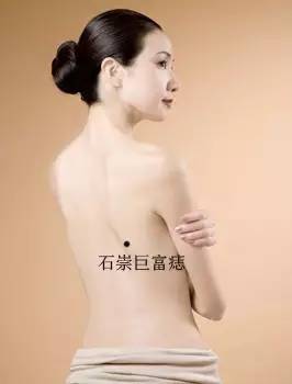 女人身上的8種福痣5種禍痣 女人身上的8種福痣5種禍痣
