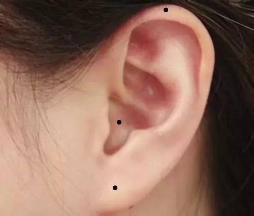 女人身上的8種福痣5種禍痣 女人身上的8種福痣5種禍痣