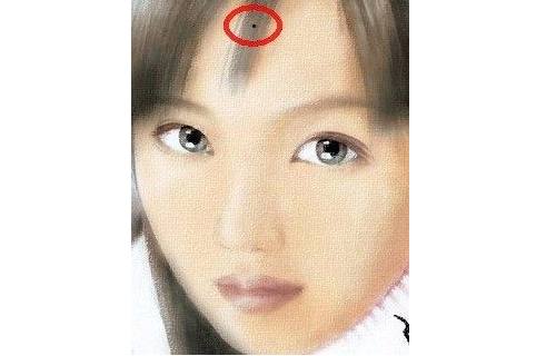額頭上長(zhǎng)了兇痣如何化解？