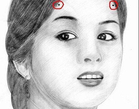 額頭上長(zhǎng)了兇痣如何化解？